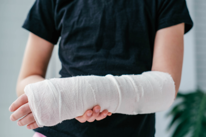 Child hoding arm in cast